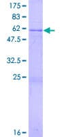 Human CEP41 / TSGA14 Protein (Recombinant GST)