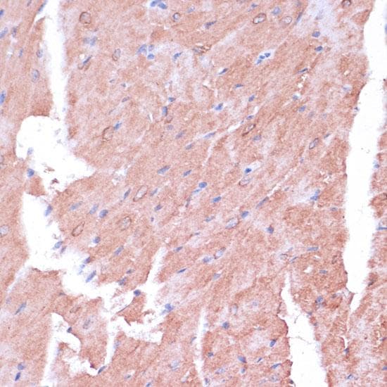 Polyclonal Rabbit anti-Human TIMM8B Antibody (IHC, IF)