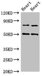 ACSS2 / ACAS2 Antibody