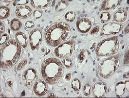 TAPBPL / TAPBPR Antibody (clone OTI4H5)