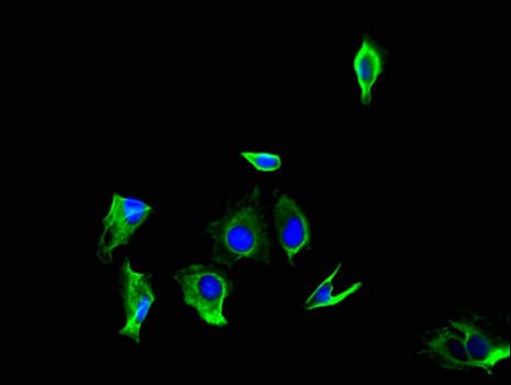 GPR179 Antibody