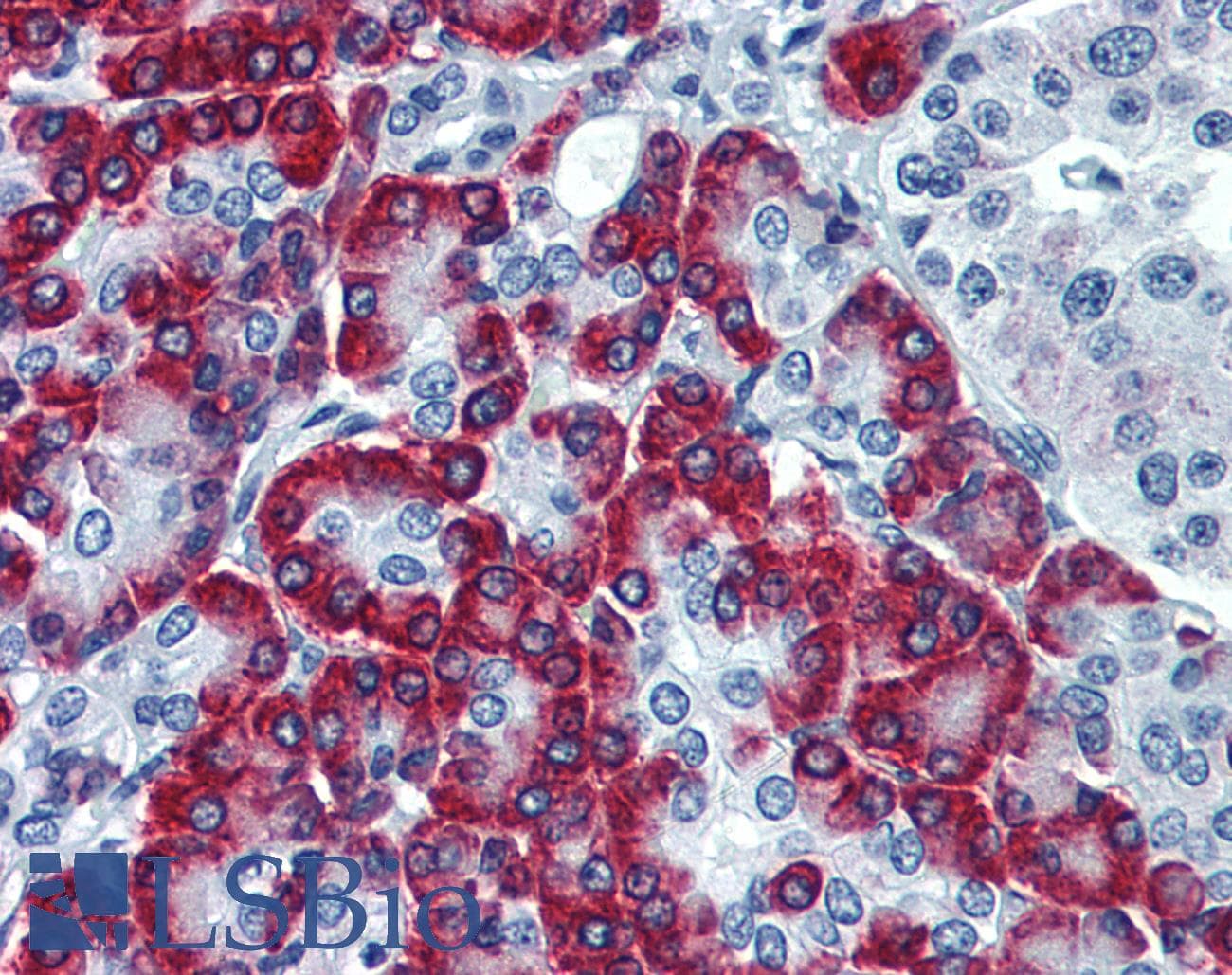 IHC-plus™ Monoclonal Mouse anti-Human SSR1 Antibody (clone 1A12, IHC, WB)