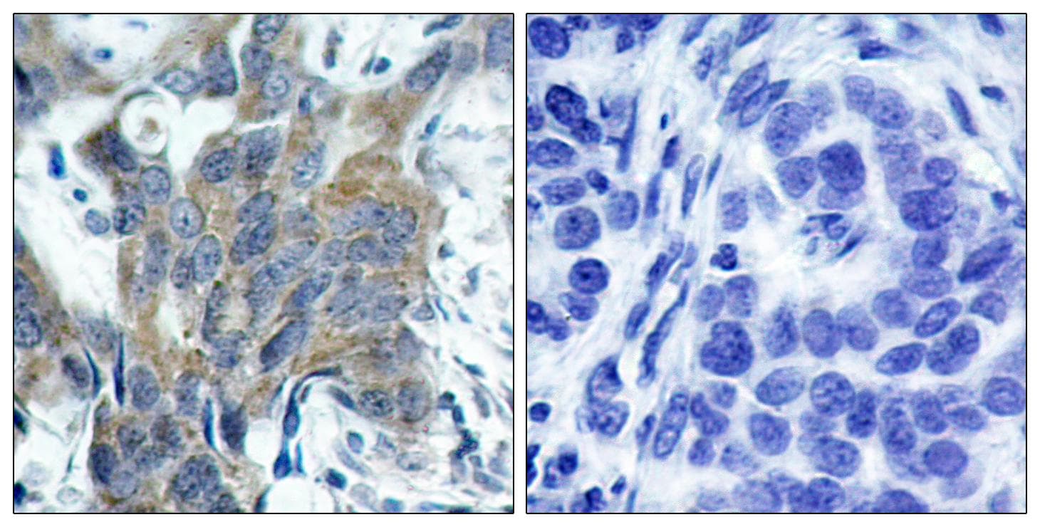 CTNNB1 / Beta Catenin Antibody (phospho-Ser33)