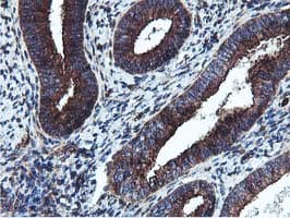 EPN2 Antibody (clone OTI1H3)