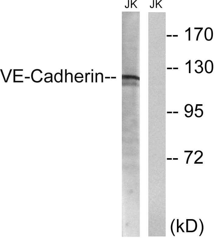 IHC-plus™ CD144 / CDH5 / VE Cadherin Antibody (aa697-746)