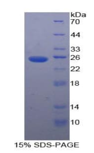 Human PKLR Protein (Recombinant His-T7)