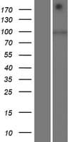 SIDT1 Protein (Over-Expression Lysate Myc-DDK (Flag))