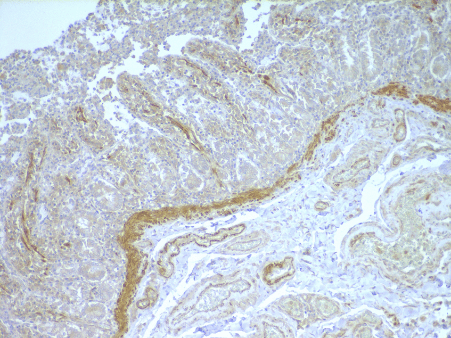 Monoclonal Mouse anti-Human NOD2 / CARD15 Antibody (IHC, WB)