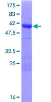 Human C21orf59 Protein (Recombinant GST)
