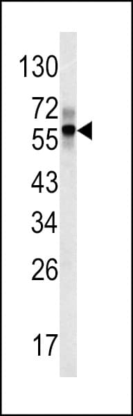 IHC-plus™ FGB / Fibrinogen Beta Chain Antibody (aa330-357)