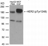ERBB2 / HER2 Antibody