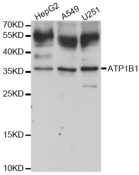 ATP1B1 Antibody