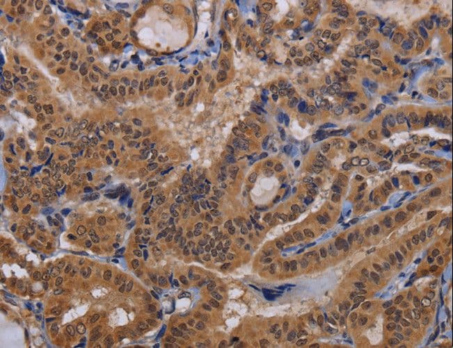 MCTS1 Antibody