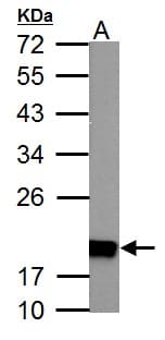 NDUFS4 Antibody (aa1-175)