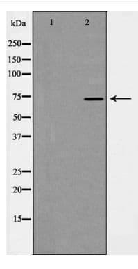 HSPA9 / Mortalin / GRP75 Antibody