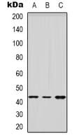 HSD3B2 Antibody (Internal)