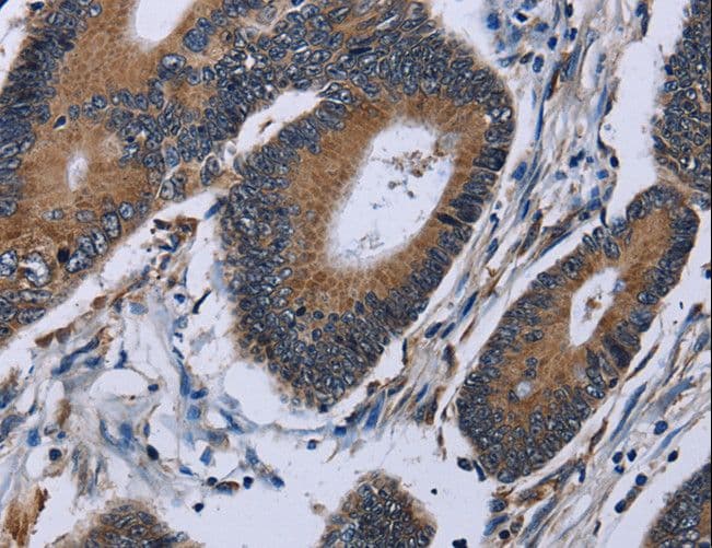 IPO4 Antibody