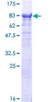 Human TTC30B Protein (Recombinant GST)
