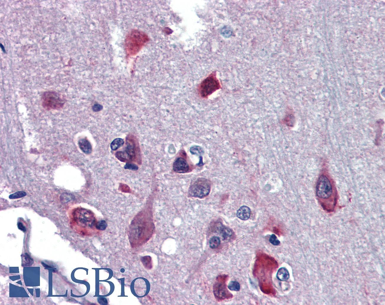 Polyclonal Rabbit anti-Human NR2E1 / TLX Antibody (aa95-144, IHC, WB)