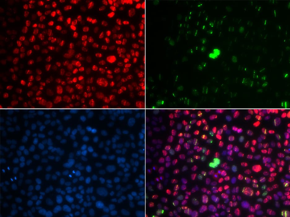 ATM Antibody (phospho-Ser1981)