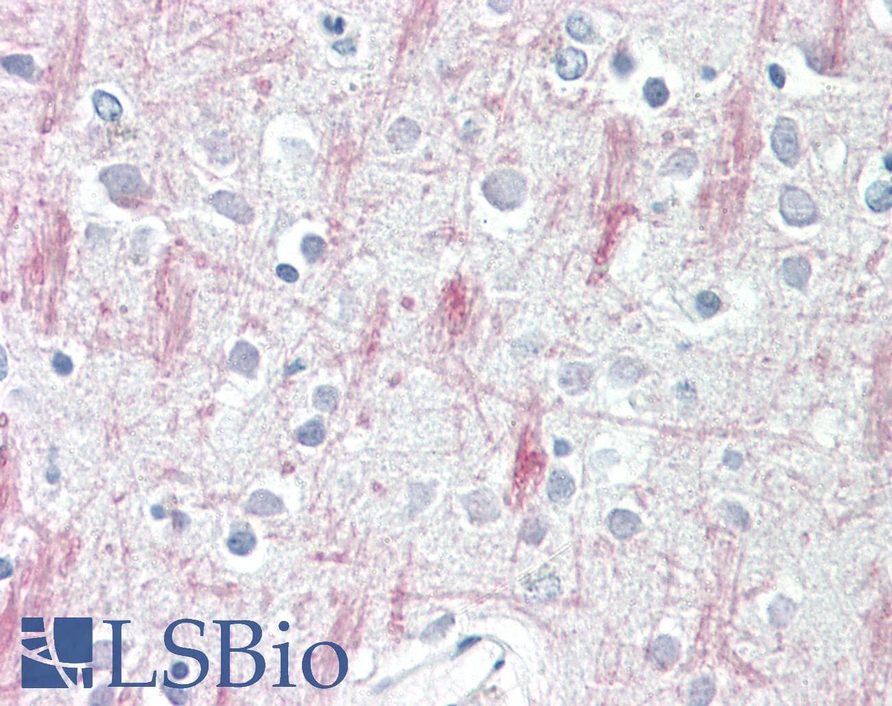 IHC-plus™ ADGRA3 / GPR125 Antibody (aa1098-1109)