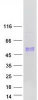 Human ARSB / Arylsulfatase B Protein (Recombinant Myc-DDK (Flag))