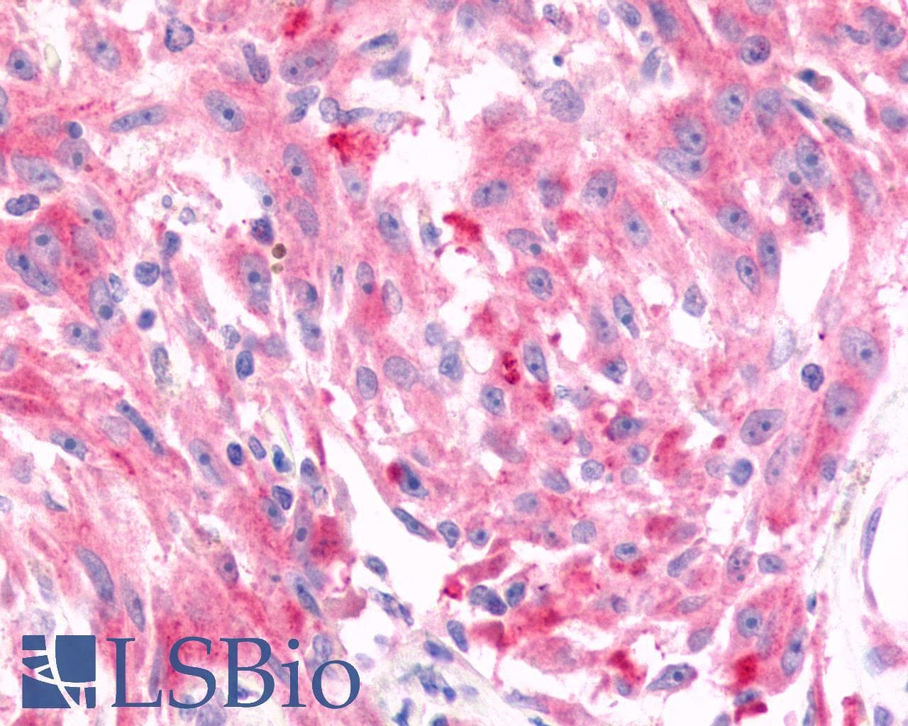 PathPlus™ Polyclonal Rabbit anti-Human FZD6 / Frizzled 6 Antibody (N-Terminus, IHC)