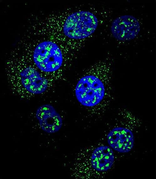 MGMT Antibody (aa1-30)