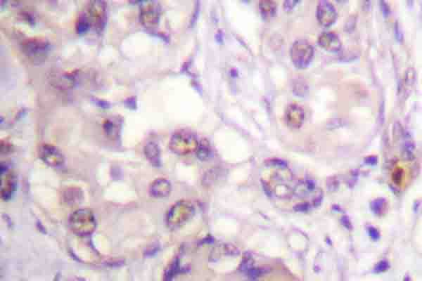 Polyclonal Rabbit anti-Human CAMK1 / CAMKI Antibody (Ser173, IHC, WB)