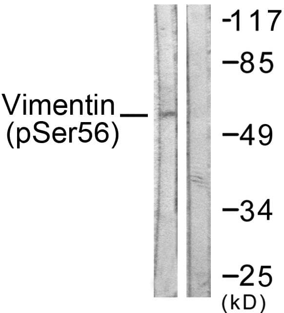 Vimentin Antibody (phospho-Ser56)