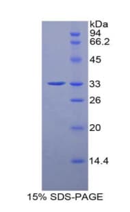 Rat HDC / Histidine Decarboxylase Protein (Recombinant His)
