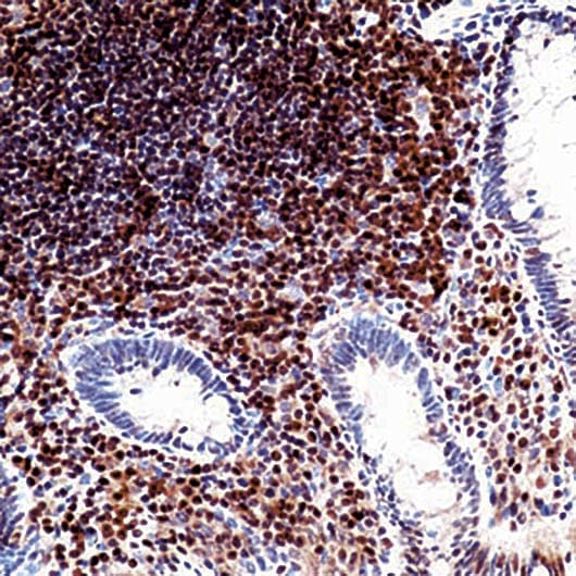 CDKN1B / p27 Kip1 Antibody (aa83-204, clone DCS-72.F6)