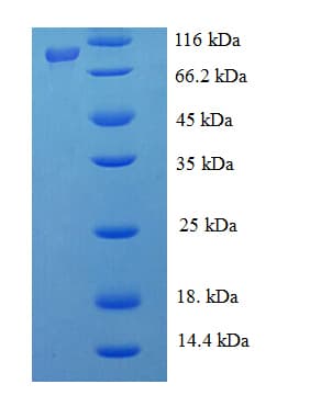 Japanese Encephalitis Virus NS5 Protein (Recombinant His-SUMO)