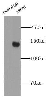 ABCB1 / MDR1 / P Glycoprotein Antibody