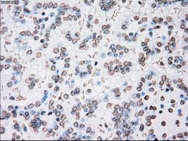 PLK1 / PLK-1 Antibody (clone OTI1A2)
