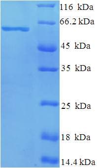 Bovine Respiratory Syncytial Virus RSV Nucleoprotein (Recombinant His-SUMO)