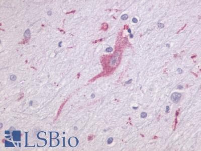 PathPlus™ ADGRL1 / LPHN1 Antibody (N-Terminus)