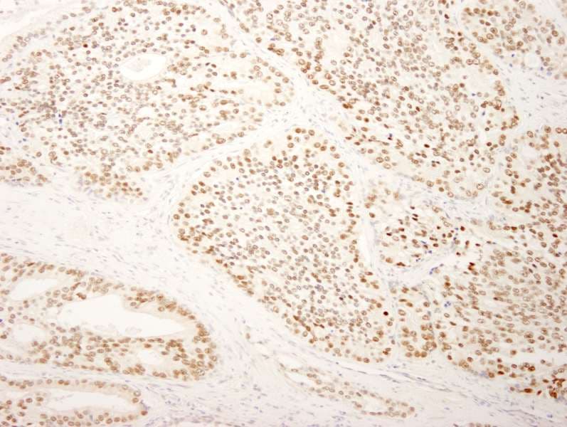 Polyclonal Rabbit anti-Human SUGP2 / SFRS14 Antibody (aa725-775, IHC, IF)