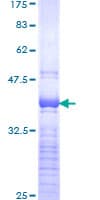 Human SOX4 Protein (Recombinant GST, N-terminus)