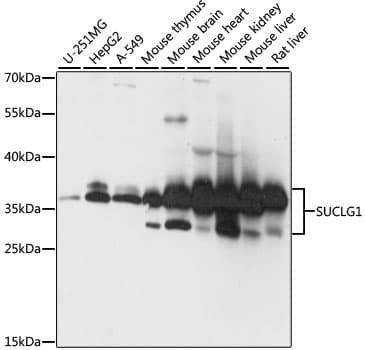 SUCLG1 / GALPHA Antibody