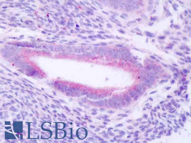 IHC-plus™ PLCZ1 Antibody (Internal)