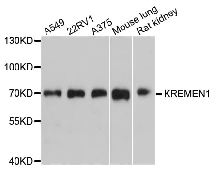 Polyclonal Rabbit anti-Human KREMEN1 / KREMEN-1 Antibody (WB)