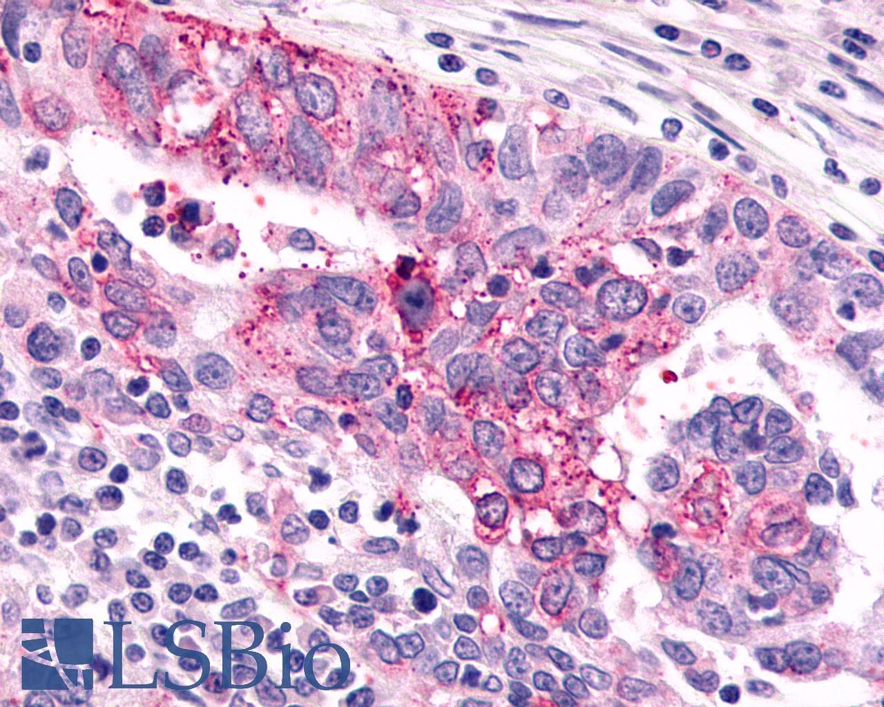 PathPlus™ GRM6 / MGLUR6 Antibody (N-Terminus)