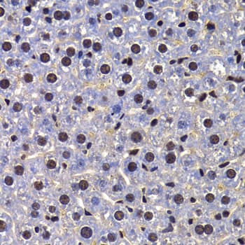 HFip1 / FIP1L1 Antibody