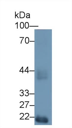 HEXA Antibody (aa319-528)