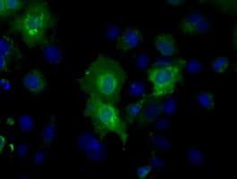 Basigin / Emmprin / CD147 Antibody (clone OTI3H1)