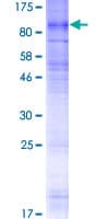 Human SLC28A2 Protein (Recombinant GST)