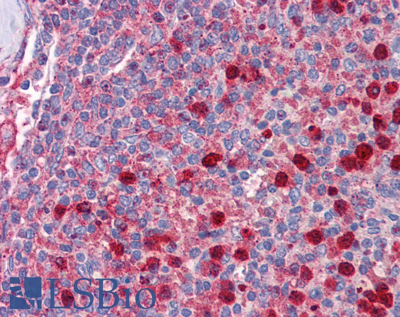 RPL5 / Ribosomal Protein L5 Antibody (aa35-84)