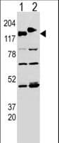 Polyclonal Rabbit anti-Human CLASP2 Antibody (Tyr1019, WB)