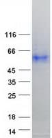 Human TMPRSS4 Protein (Recombinant Myc-DDK (Flag))